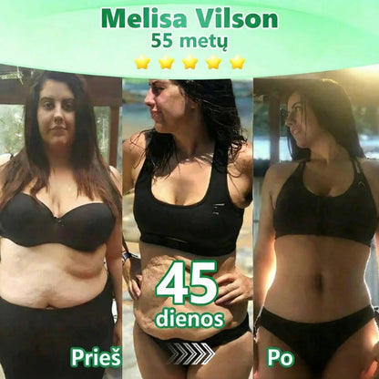 Grynieji pinigai pristatymo metu [70% nuolaida] Florisma® 👩‍⚕️ Moringa + BERBERINAS + NAD+ Liekninantis ir Stangrinantis 10-in-1 Nano Mikroadatinis Pleistras. 🏆